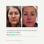 Collagen Restore™